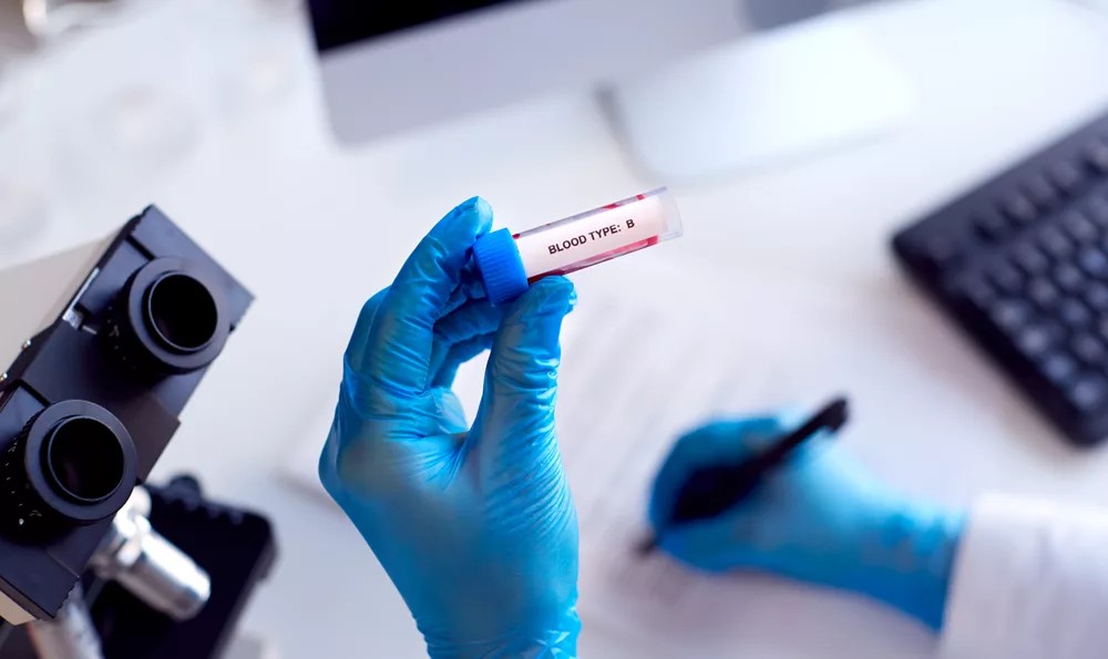 A blood sample being analyzed in a lab, representing health and wellness research.