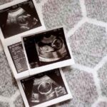 Understanding Your Baby Scan Results - Visual Guide