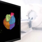 Heart CT Scan Procedure