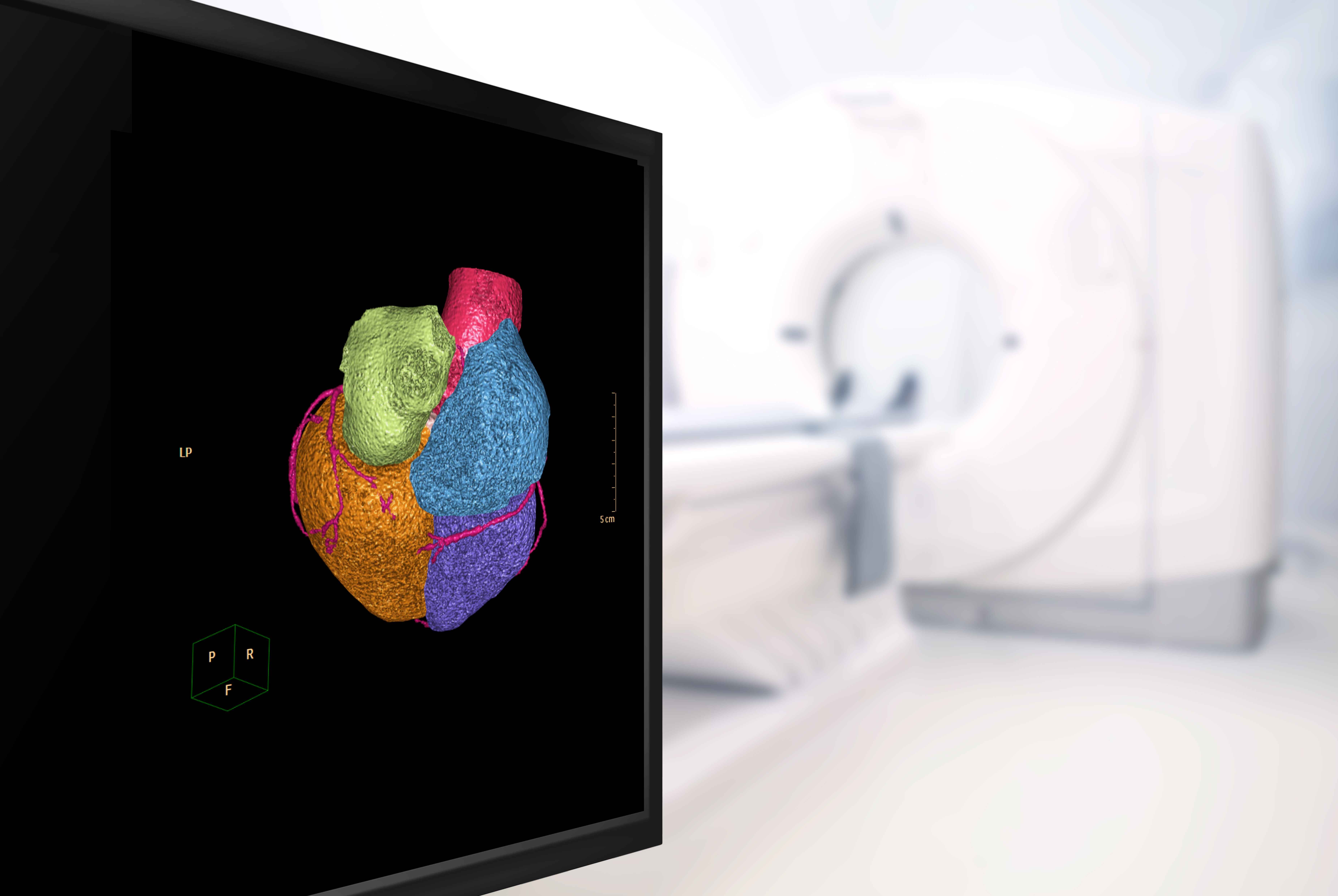 Heart CT Scan Procedure